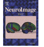 Neruoimage n.55, 1