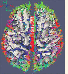 Cerebral Cortex