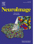 Neuroimage 63